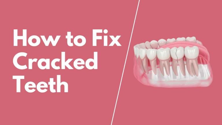 How To Fix Cracked Teeth A Comprehensive Guide In 2023