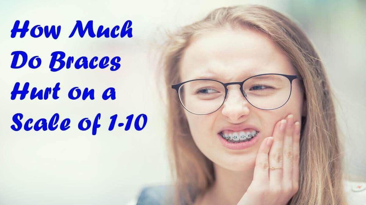 How Much Do Braces Hurt on a Scale of 1-10?