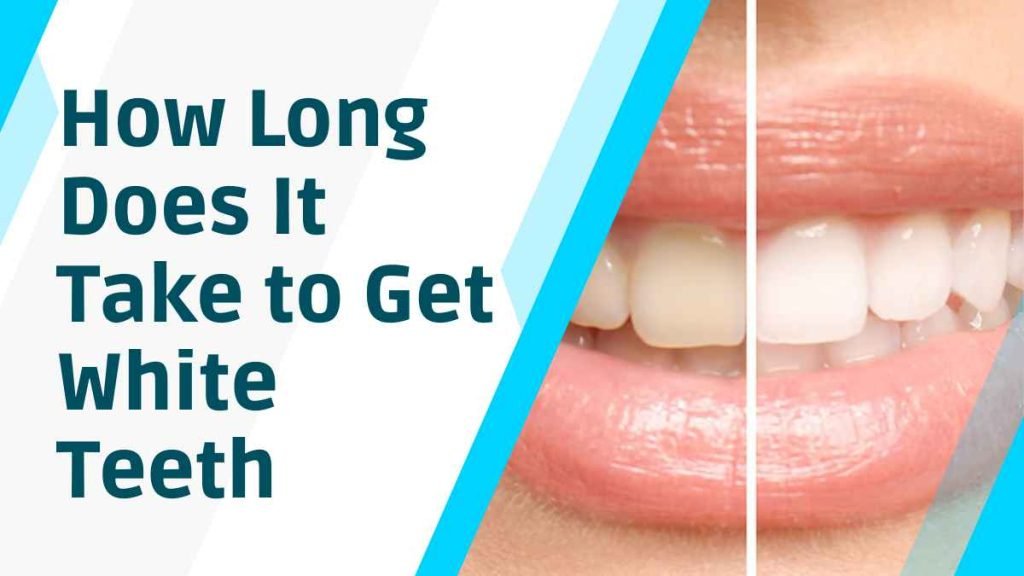 How Long Does It Take to Get White Teeth