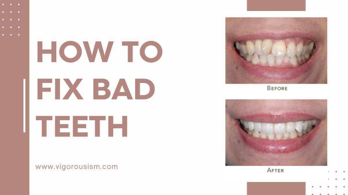 How to Fix Bad Teeth: A Comprehensive Guide in 2023