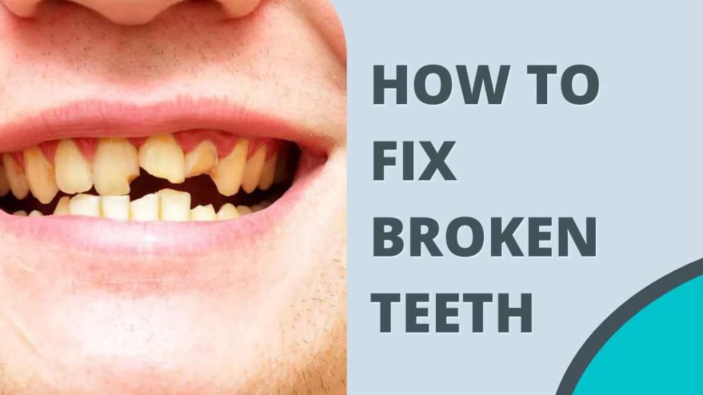 How to Fix Broken Teeth