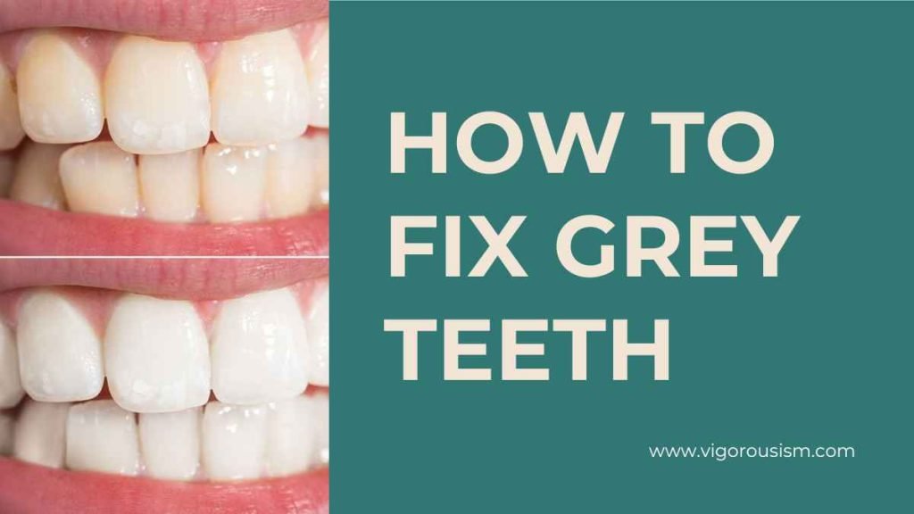 How to Fix Grey Teeth