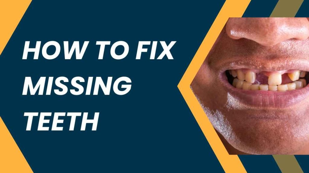 How to Fix Missing Teeth