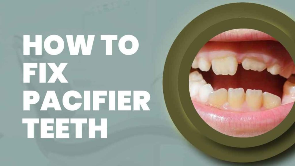 How to Fix Pacifier Teeth
