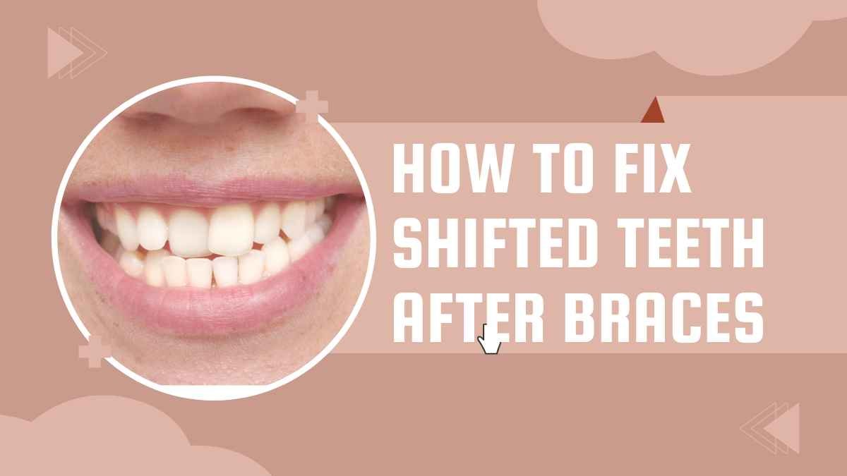 How to Fix Shifted Teeth After Braces: A Comprehensive Guide in 2023