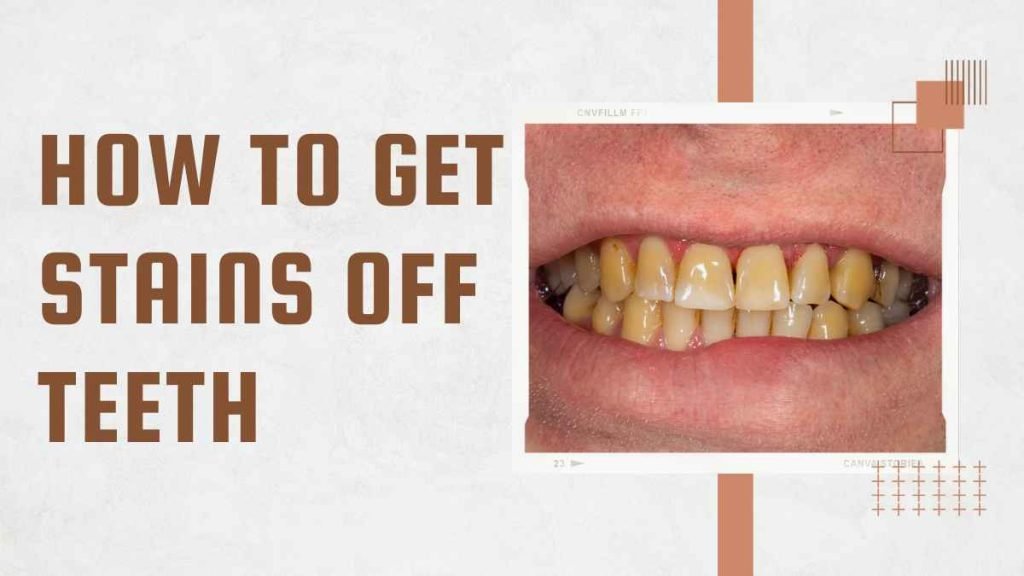 How to Get Stains Off Teeth