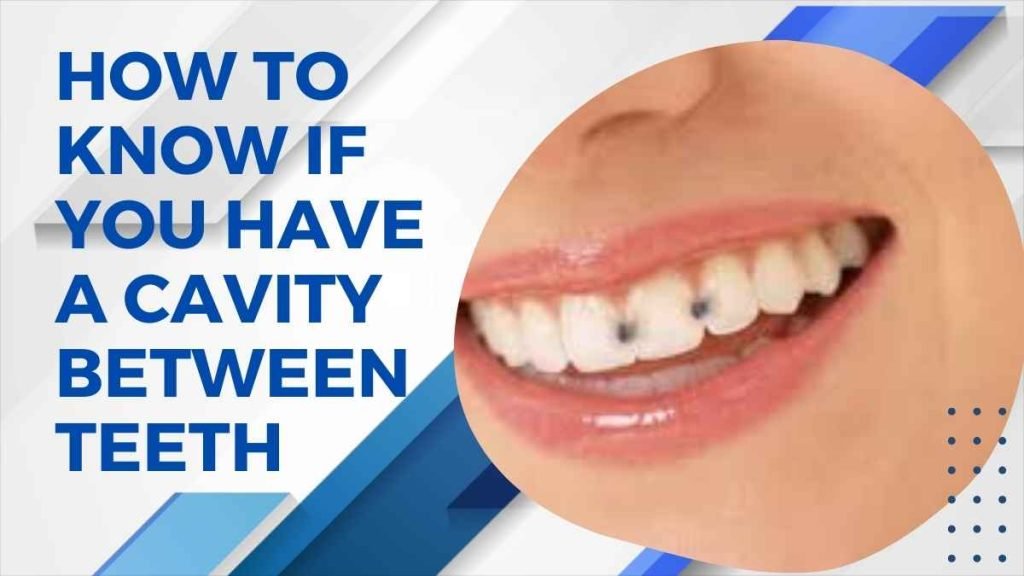 How to Know If You Have a Cavity Between Teeth