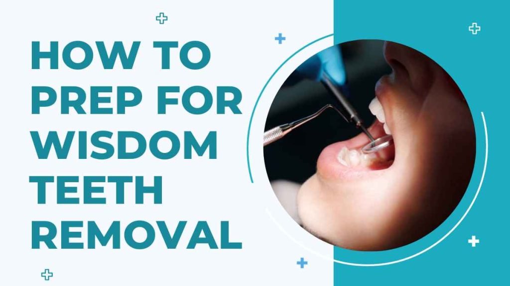 How to Prep for Wisdom Teeth Removal
