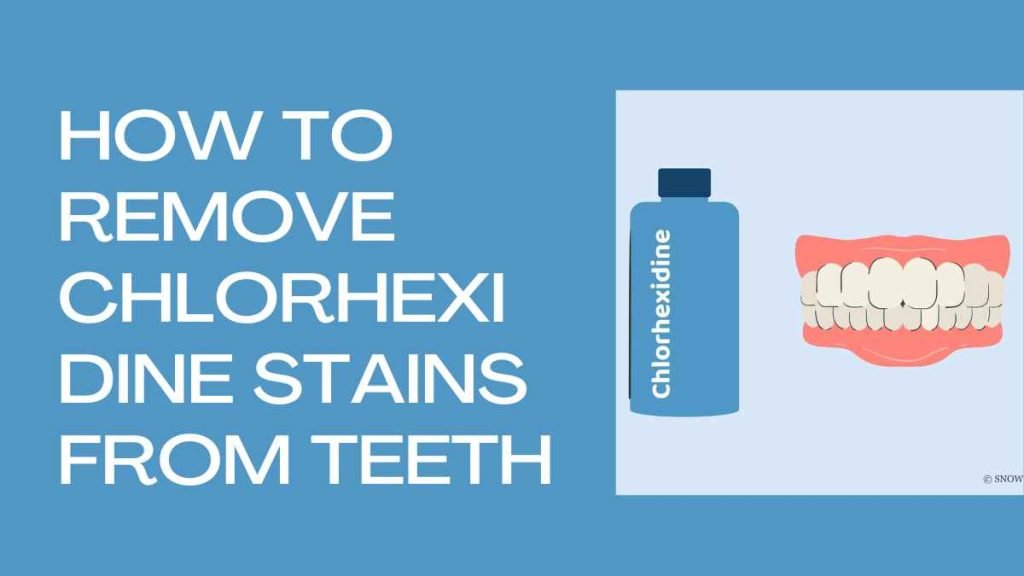 How to Remove Chlorhexidine Stains from Teeth