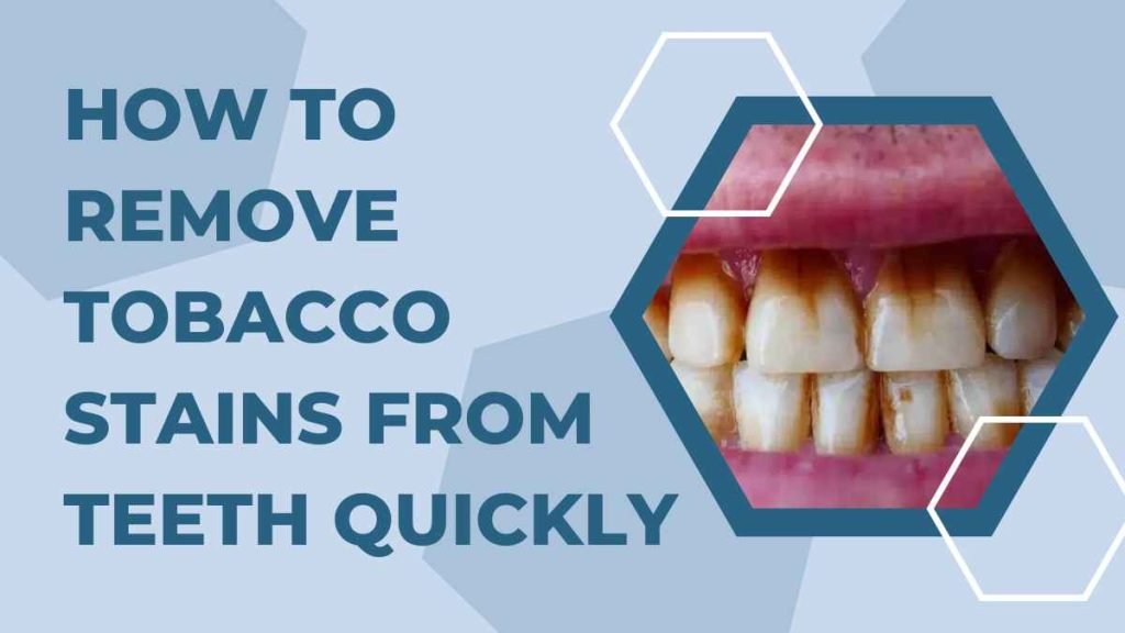 How to Remove Tobacco Stains from Teeth Quickly