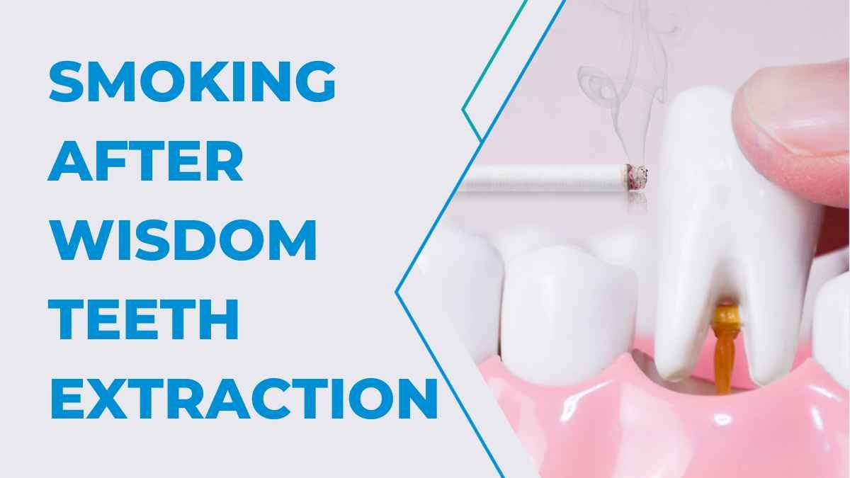 Smoking After Wisdom Teeth Extraction: A Comprehensive Guide 2023