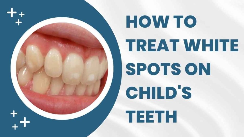 How to Treat White Spots on Child's Teeth