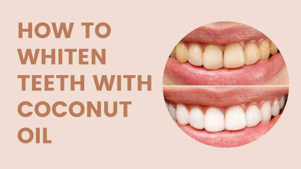 How to Whiten Teeth with Coconut Oil